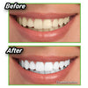 Activated Coconut Charcoal Teeth Whitener - Natural & Fast Acting